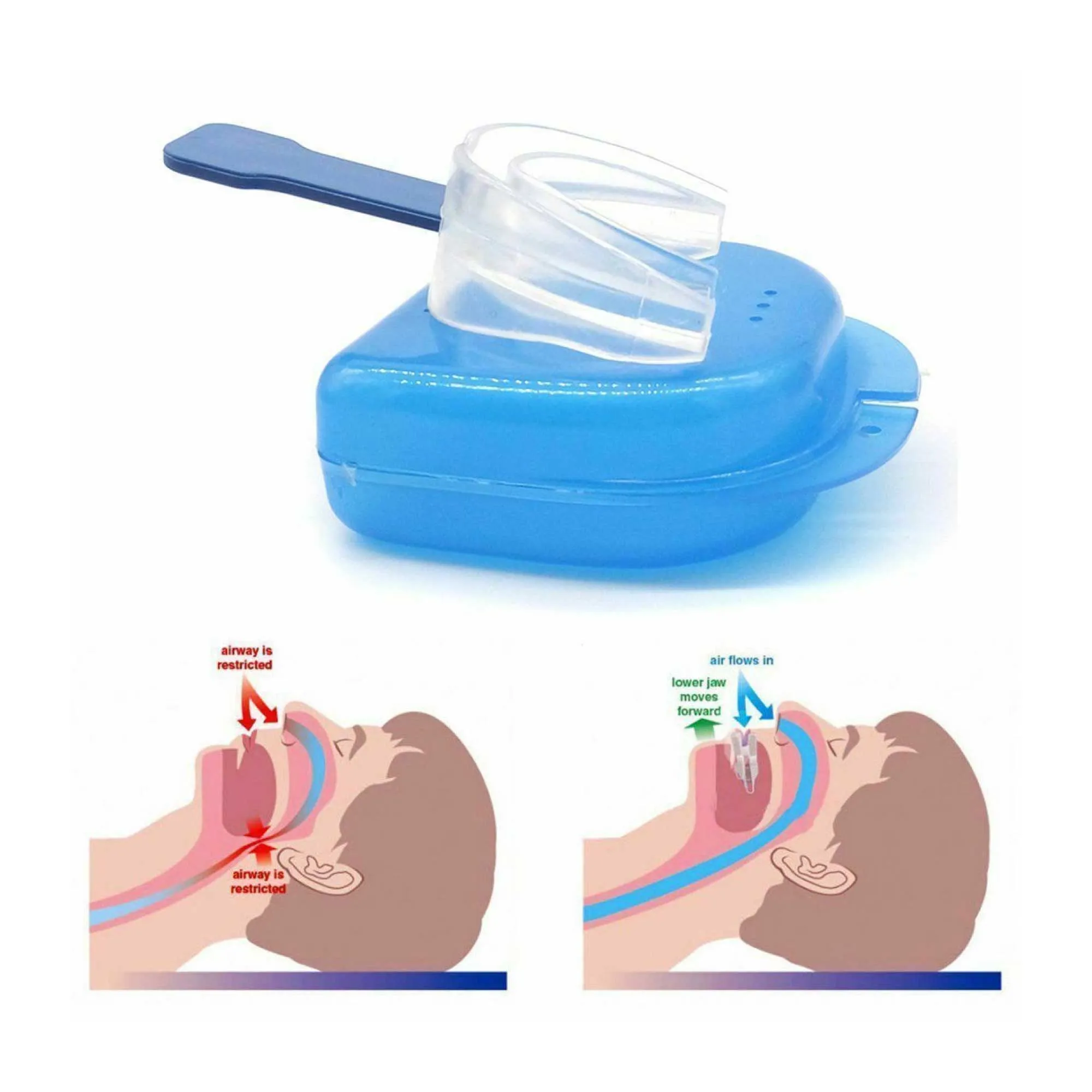 Anti-Snoring Soft Silicone Mouthpieces & Nose Clips Set